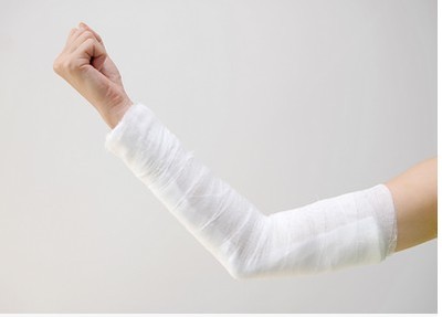 Glass fiber high molecular splint high molecular plaster tightening limb fracture fixing splint (anxin)