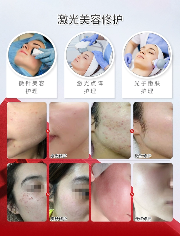 Asherin vì mặt nạ Tencel với microneedles nhạy cảm với làn da nhạy cảm sau ánh nắng mặt trời làm dịu dưỡng ẩm giữ ẩm mà không cần chất bảo quản - Mặt nạ