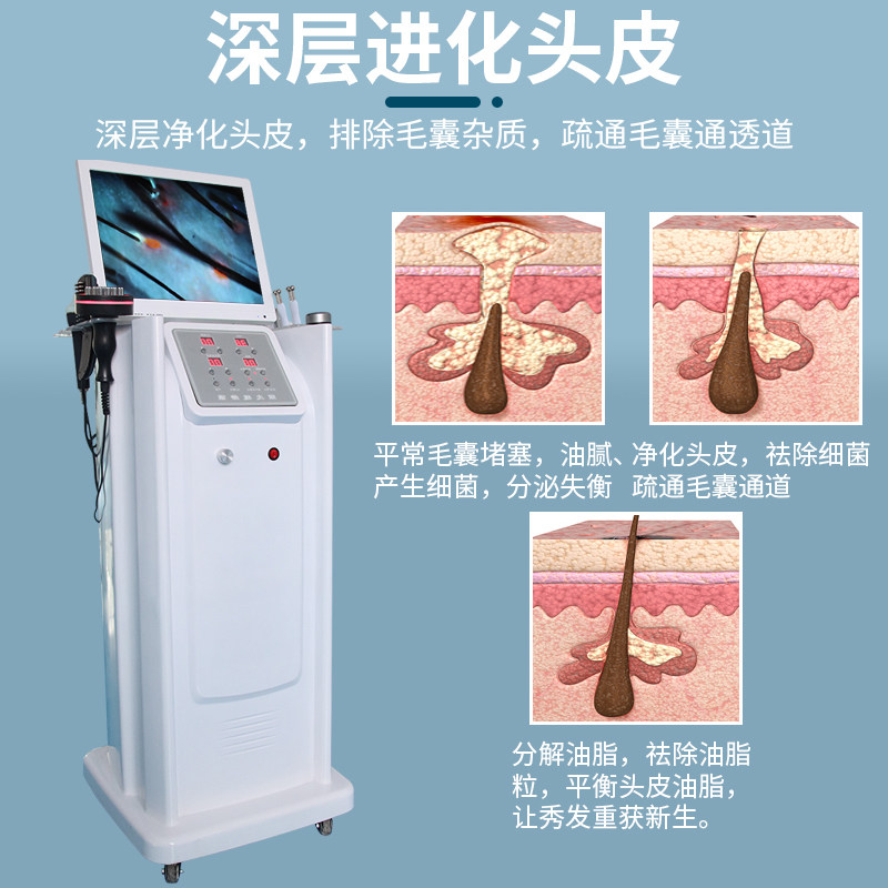 头皮检测仪器真能防脱发？2026年养发馆都在用的“毛囊高清一体机”到底值不值？