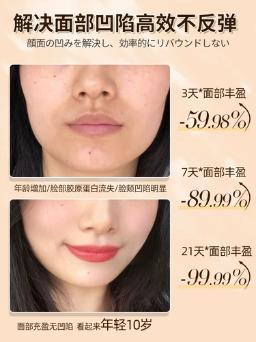 Снимите храм слезной канавы фэн, щеки, депрессия, заполняя глаз лоб глазного лоба, фиксируя полное