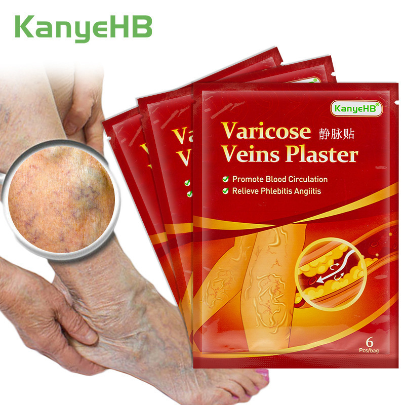 Kanyehb Vein Patch Cross-Border Wish Amazon Varicose Veins Patch