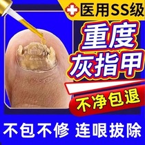 同仁堂热卖10万 不包不修(滴一滴)无痛去除手脚趾坏钾 灰钾克星