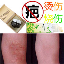 Miracle Grass Essence Repair Liquid removes post-surgery smoke burns softens and removes hyperplasia burns bumps and scars