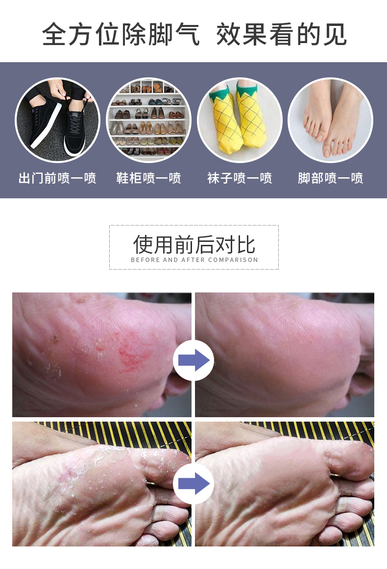 德国原装进口 SOS 足部抑菌除味喷雾 250ml 去鞋臭脚气 图5
