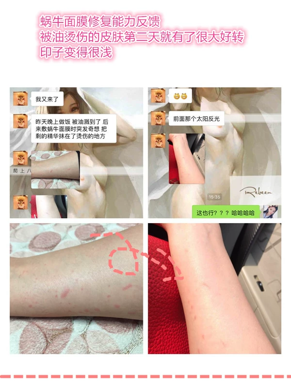 Đĩa đơn! 5 bức ảnh (trừ điều khiển từ xa)! ! Mask 百 Mặt nạ dưỡng ẩm bằng nước ốc sên