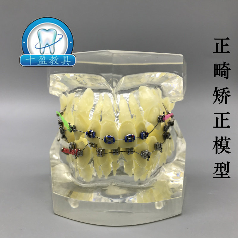 牙科口腔正畸模型 水晶透明错颌牙列矫正展示模型 医患沟通讲解