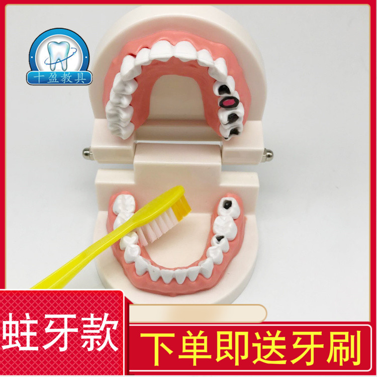 牙科口腔模型 儿童蛀牙模型 幼儿园教刷牙学模型 龋齿病理模型