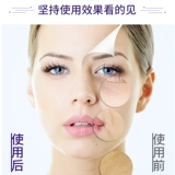 锦上添花 Подтягивающий косметический массажер для лица