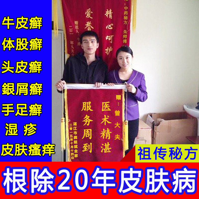 Kraft topical skin special for the treatment of allergic pruritus urticaria femoral moss ringworm root eczema antipruritic and root removing ointment