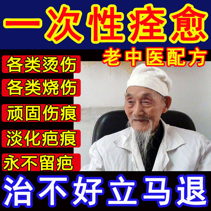 Burn Scalds Medicine Electrowelded Fire Oil Boiled Water Scald Ointment Water Bubble Face Adults External Burn Cream Children Ointment