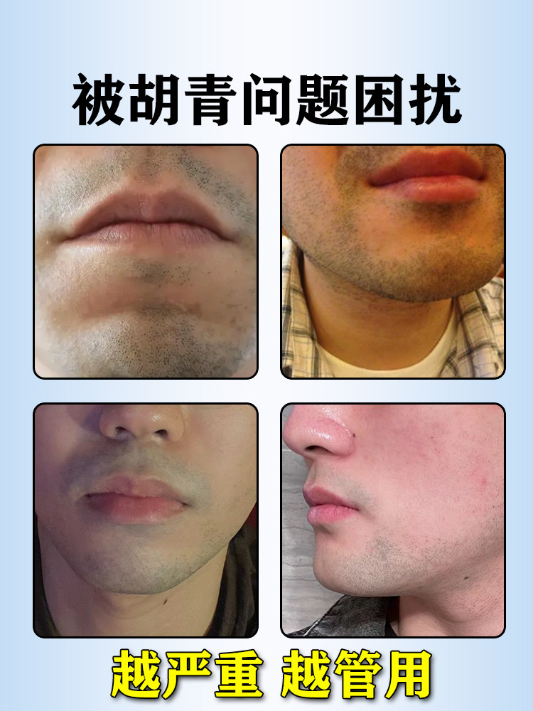 胡青去除男士淡化胡子黑印胡茬络腮胡唇毛胡根刮完护理遮瑕膏脸女,真的有效吗?_脱毛膏_淘宝美妆网