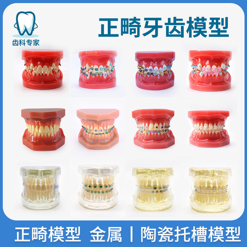 Tooth model mold orthodontic half-metal half-bracket standard dental model orthodontic implant repair oral teaching tooth model