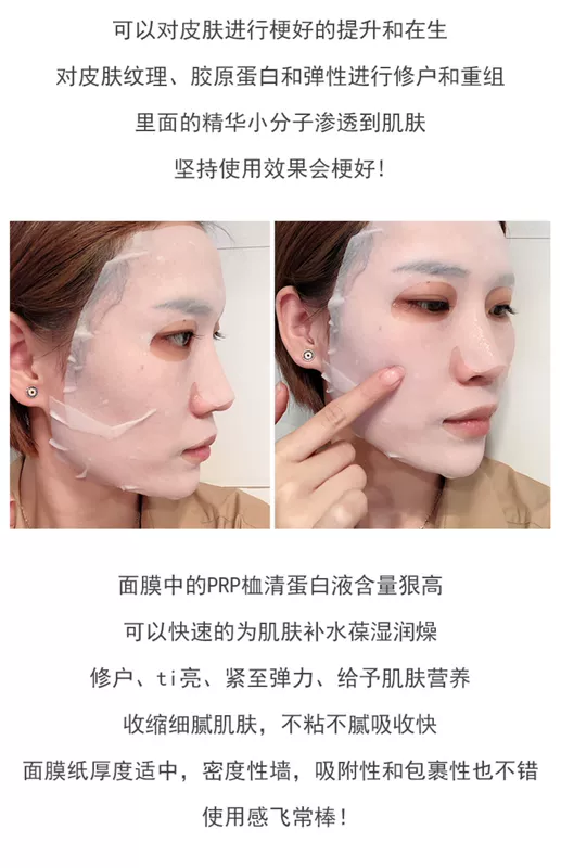 Nhật Bản Gik PRP Serum Collagen Mask Giữ ẩm đàn hồi nâng lên 14 miếng - Mặt nạ