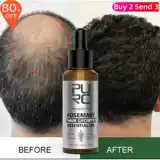 Роста роста роста роста масла продукты для быстрого потери