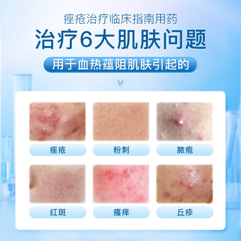 痘痘肌福音！复方珍珠暗疮片，内外兼修打造健康肌肤-皮脂汗腺-淘宝好物网