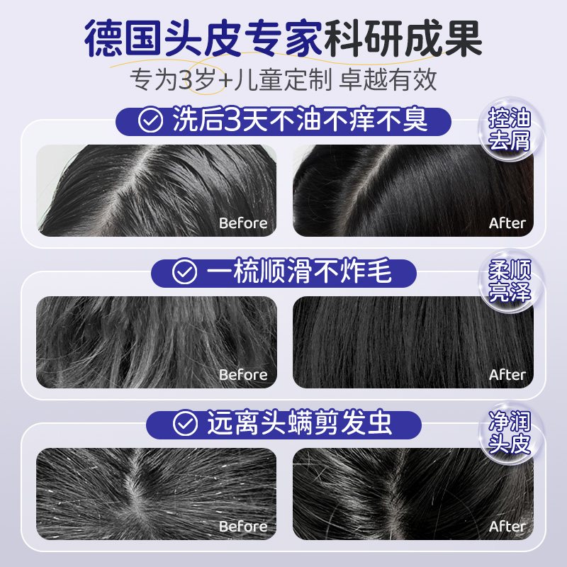 大人洗发水适合给小孩使用吗？儿童洗护产品的真相