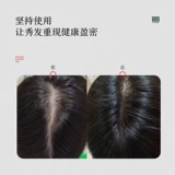 章光101 Лечебный питательный раствор для кожи головы подходит для мужчин и женщин, 120 мл