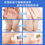 Вазелин, крем для пяток, питательный защитный крем для ног, крем для рук, против трещин