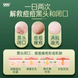 999 Витаминизированная мазь, очищающее молочко от экземы от черных точек, 20г, анти-акне