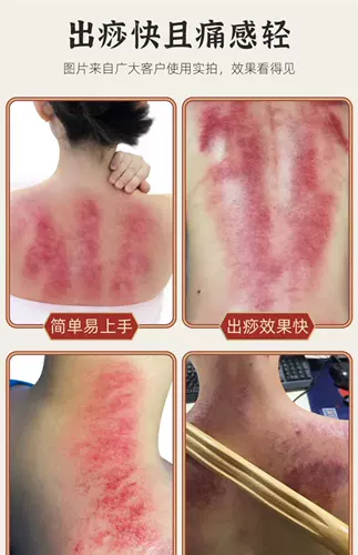 Генеральный -кусочка накапливающих палочек стержневой палоч