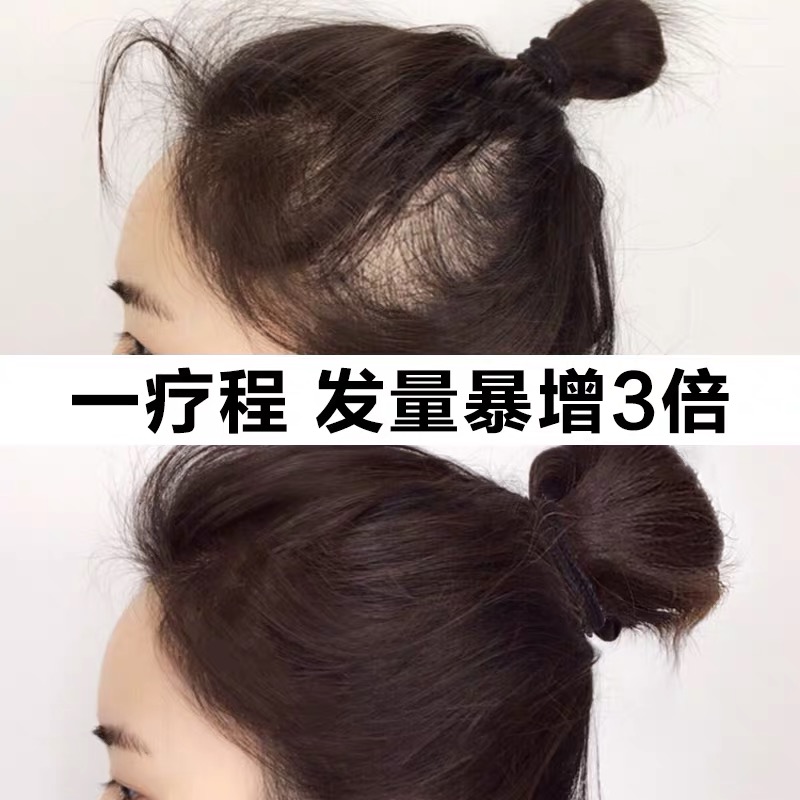 (Recommended by Li Jiaqi) The natural growth rate of hair is dense for men and women.