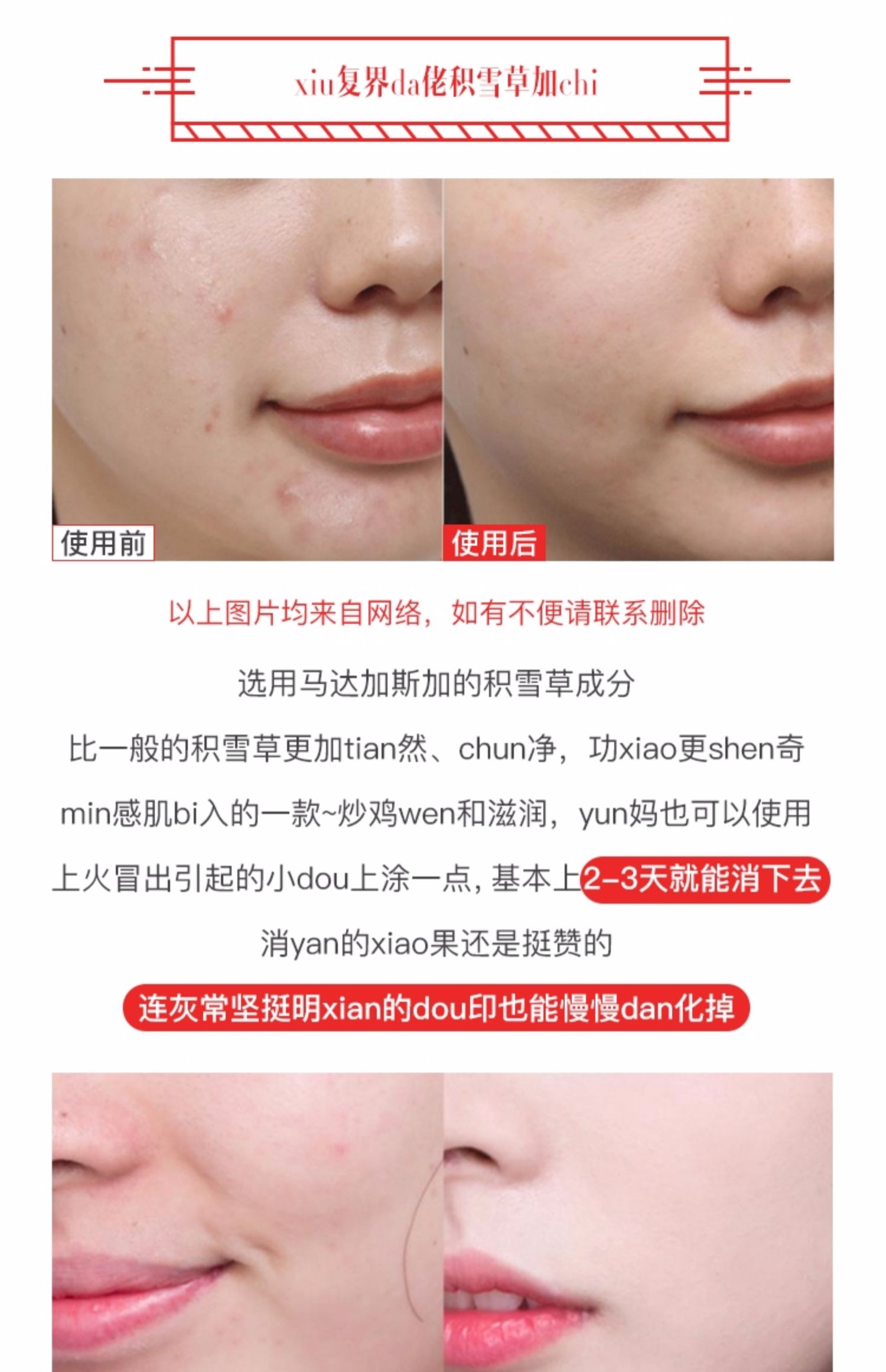 Lớn lên ở Hàn Quốc Đông Khang Dược phẩm Centellian24 Center Lotus Snow Cover Cream Repair dưỡng ẩm - Kem dưỡng da kem dưỡng da cho da dầu