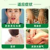 科达制药 Shiwei Baidu Отвар, фолликулит, фурункулы, рожа, экзема, ячмень, покраснение и отек прыщей, китайское патентованное лекарство 200г