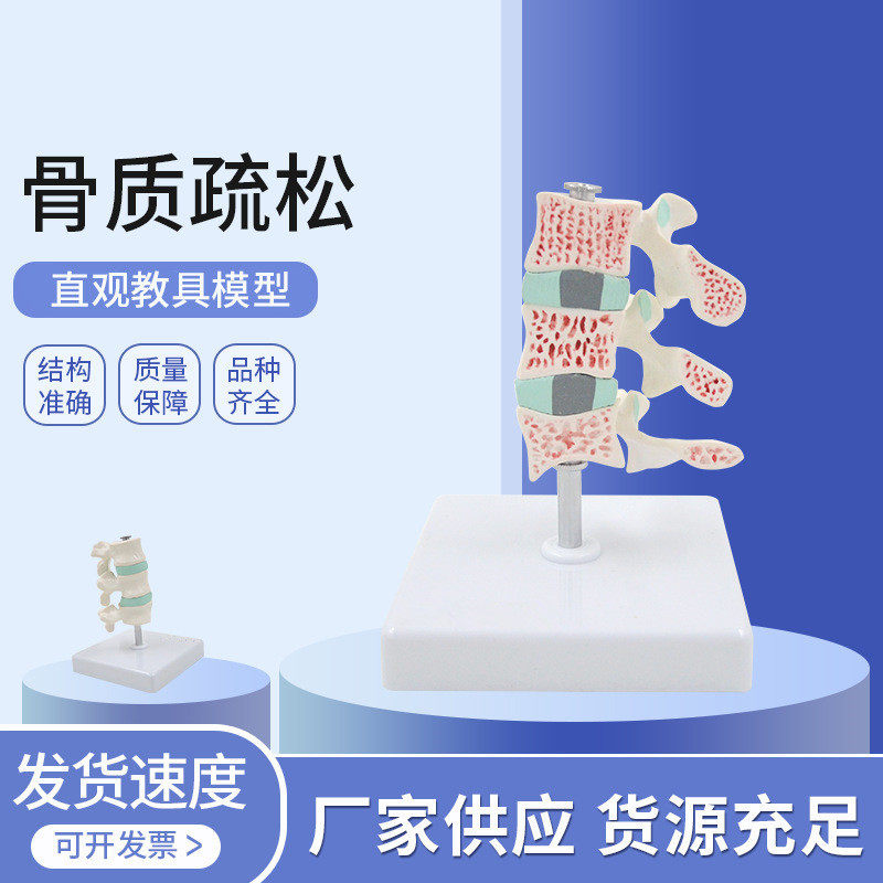 Osteoporotic Lesion Model Human Skeletal Ridge Cervical Spine Anatomical Joint Model Anatomical Foundation Specimen