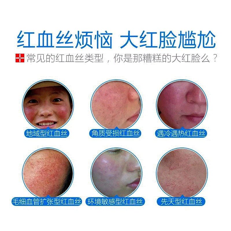 敏感肌肤过敏皮肤红血丝舒敏晒后修复润肤素颜霜护肤面霜女