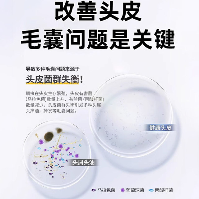 Sulfur Shampoo, Anti-Dandruff, Anti-Itch, Scalp Mites, Acne Hair Follicles, Itchy Hair, Mite Removal, Oil Control, Head Lice, Shanghai Shampoo