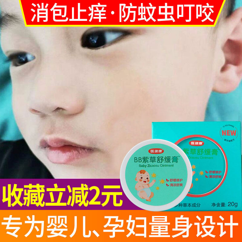 Baby Anti-mosquito bites Bite Cream Inflammation of the Anti-Itch Mild natural No Irritating Pregnant Woman Baby Multieffect Lithospermum Cream