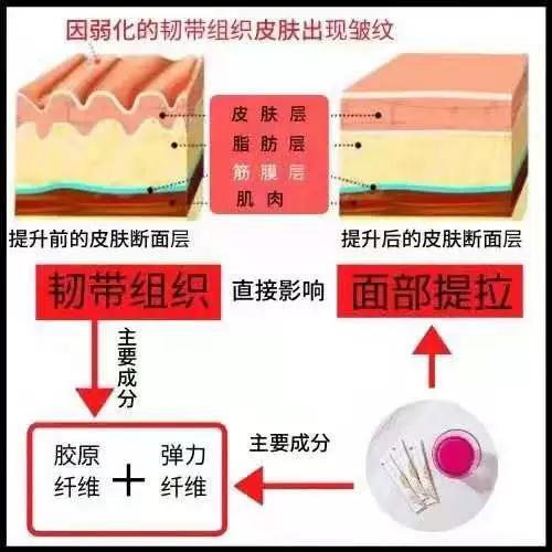 Японский эластичный разглаживающий подтягивающий трехмерный осветляющий коллаген, против морщин