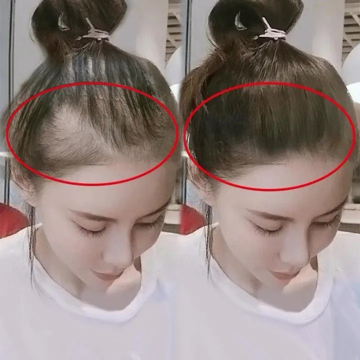 (Little Red Book recommend Buy 2 to send 1) to say goodbye to large head deities and not to bald the door-to-line nutrient solution