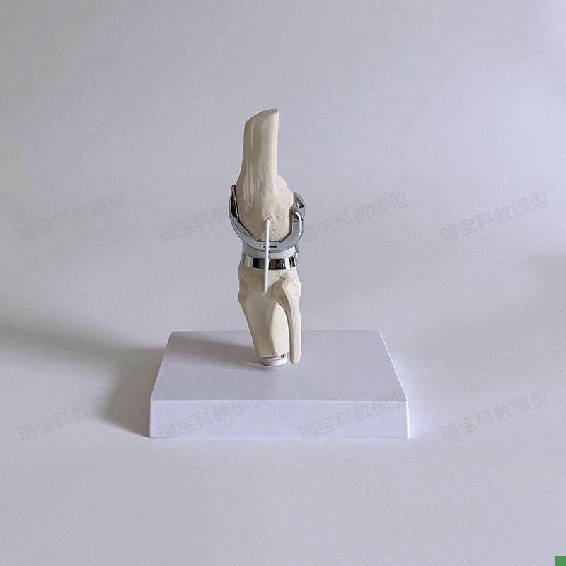 Knee Joint Artificial Prosthetic Model Meniscus Cartilage Surgery Demonstration Single-Joint Total Knee Replacement Demonstration Medical