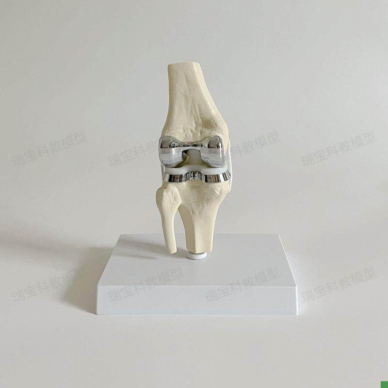 Knee Joint Artificial Prosthetic Model Meniscus Cartilage Surgery Demonstration Single-Joint Total Knee Replacement Demonstration Medical