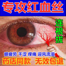 Treatment of blurred eyes red blood repair removal of dry itchy itchy eyes fatigue drops eye wash to yellow