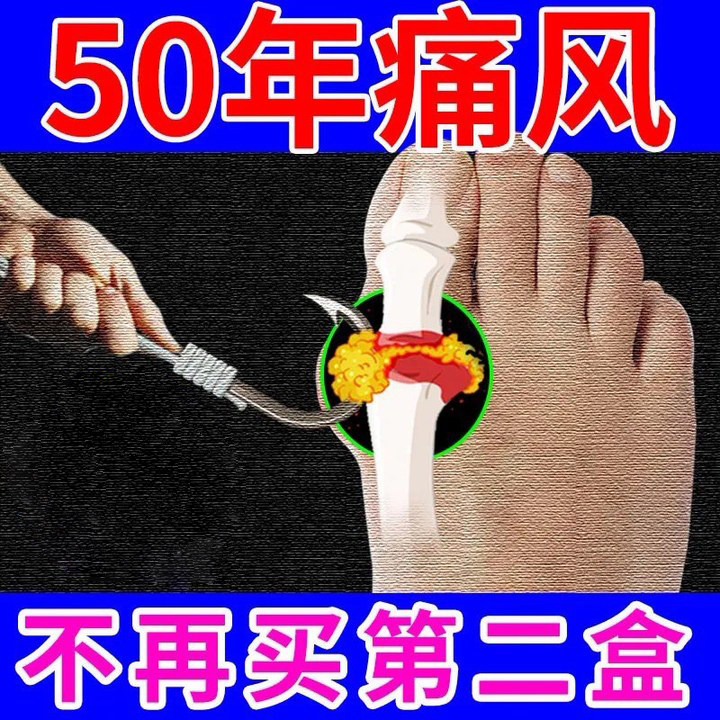 Gout patch Special use Special gout medicine Toe finger swelling Pain relieving urinary soreness Gout stone foot gout plaster