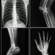 X-ray CT film printing dental viewing film