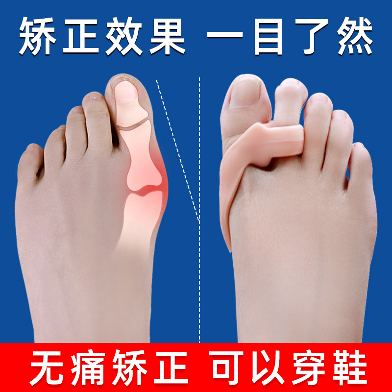 日本脚趾矫正器大脚骨女日用成人可穿鞋女大脚骨大拇指外翻矫正器