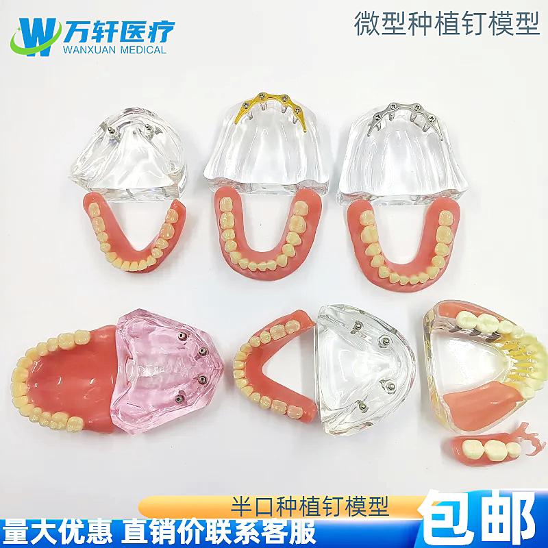 Dental Oral Teaching Model Implant Repair Comparison Model Micro Implant Nails 2 4 Nails Implant Ball Cappole