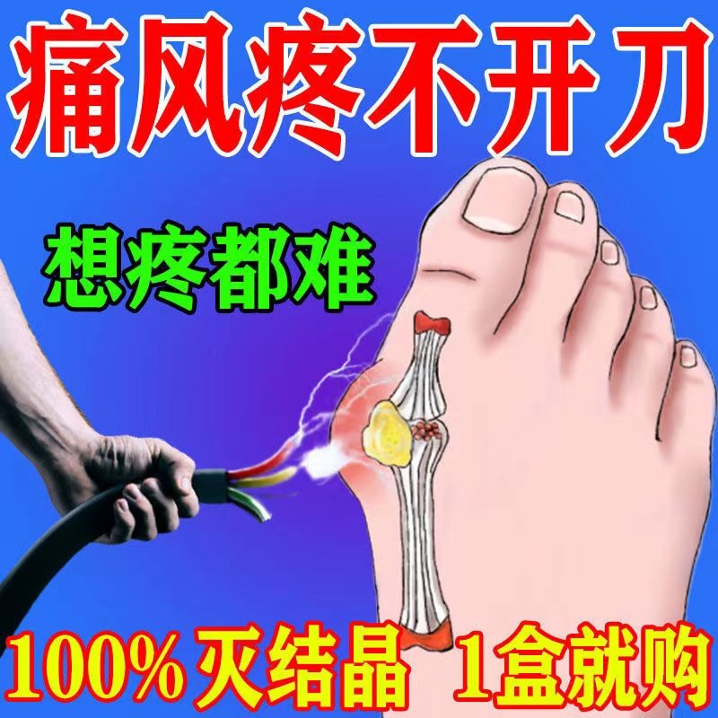 (Gout Cream One Erase Pain Relief) Gout Special Medicine High Uric Acid Recrystallization Toe Finger Joint Swollen Deformation
