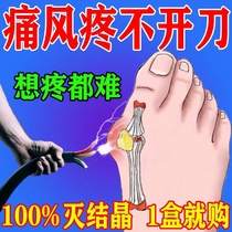 (Gout Cream One Erase Pain Relief) Gout Special Medicine High Uric Acid Recrystallization Toe Finger Joint Swollen Deformation