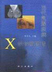 The X-ray diagnostic atlas of the genuine contemporary breast disease