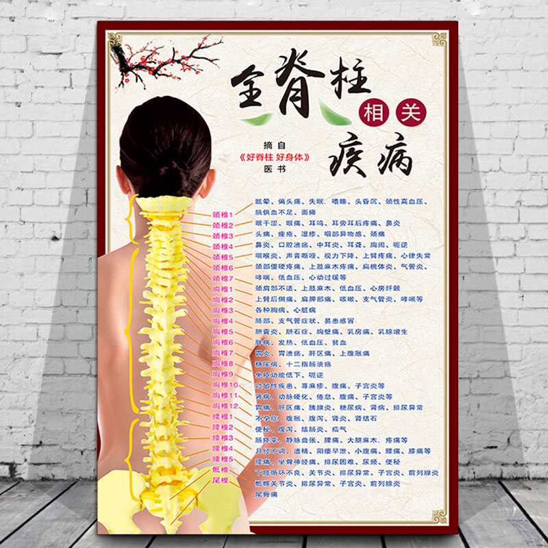 Human Ridge Post Related Disease Schematics Skeletal Anatomy Full-Appearance wall Wall Column Vertebral Segmental Neural Holography