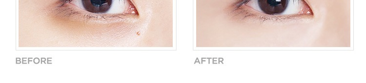 Kem che khuyết điểm xác thực che sẹo mạnh mụn đánh dấu quầng thâm đốm tàn nhang đốm trắng 皙 phấn nền kéo dài che khuyết điểm nyx