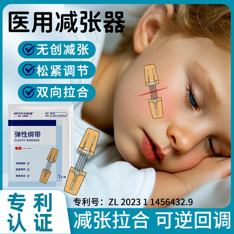 弘生医用减张器拉链式术后疤痕缝合器儿童皮肤伤口免缝减张创口贴