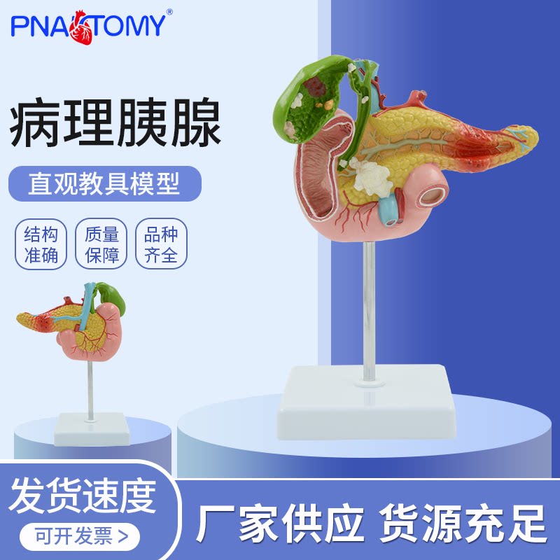 胰腺模型十二指肠胆囊病理解剖教具结石 内脏器官 消化系统展示用