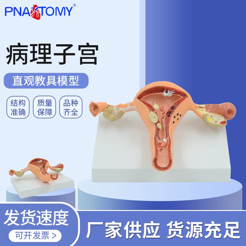 病理子宫模型教具人体卵巢解剖 女性生殖科展示阴道妇科解剖教学