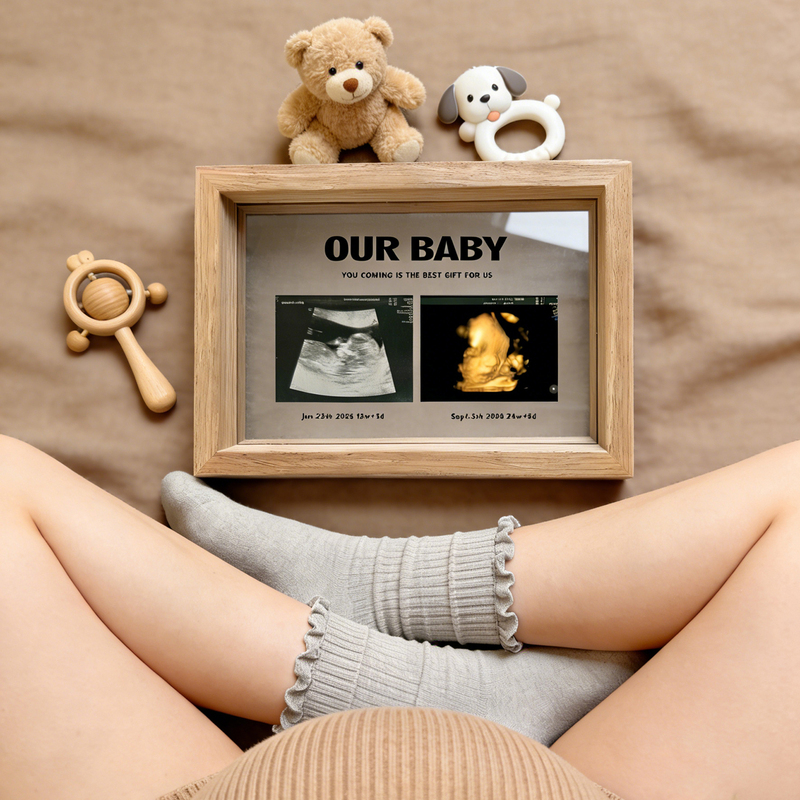 Baby's Nt Four-Dimensional Ultrasound Pregnancy Photo Designed as a Poster in a Transparent Solid Wood Frame, Personalized Record Gift to Commemorate