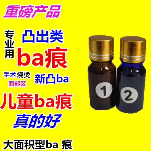 Children ba New convex ba Facial ba and surgical scalding Hyperplasia ba and recurrent hyperplasia ba marks